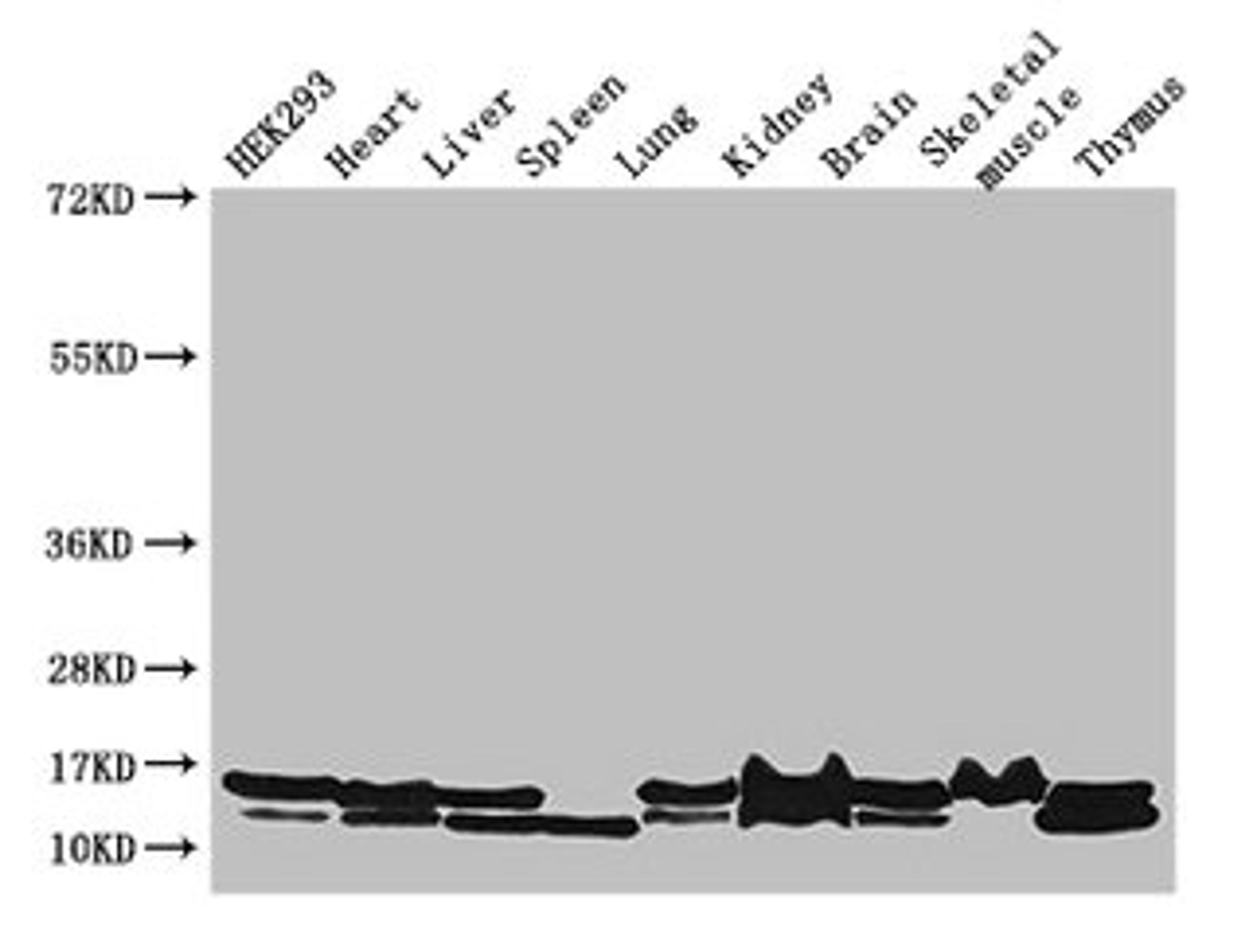 Western Blot. Positive WB detected in: HEK293 whole cell lysate, Mouse heart tissue, Mouse liver tissue, Mouse spleen tissue, Mouse lung tissue, Mouse kidney tissue, Mouse brain tissue, Mouse skeletal muscle tissue, Mouse thymus tissue. All lanes: NDUFB6 antibody at 3µg/ml. Secondary. Goat polyclonal to rabbit IgG at 1/50000 dilution. Predicted band size: 16, 14 kDa. Observed band size: 16, 14 kDa