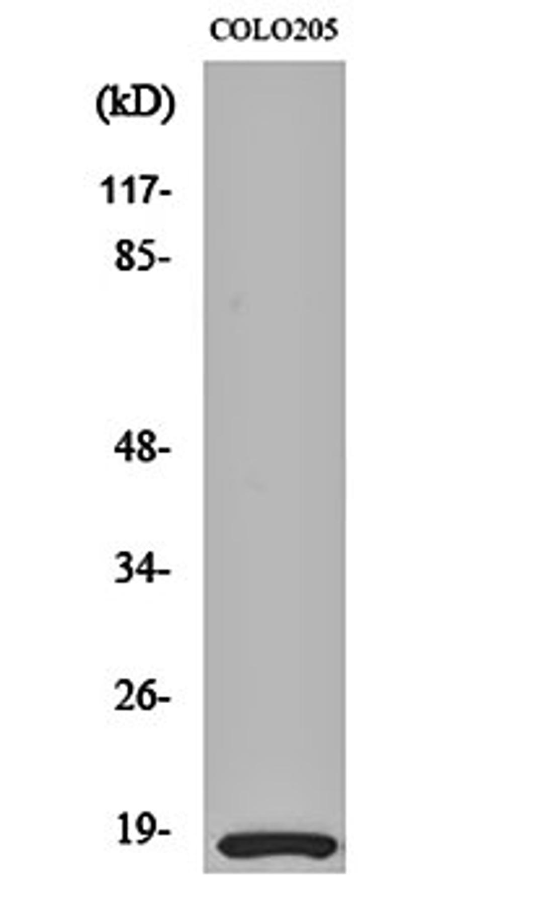 Western blot analysis of COLO205 cell lysates using MRLC2 antibody