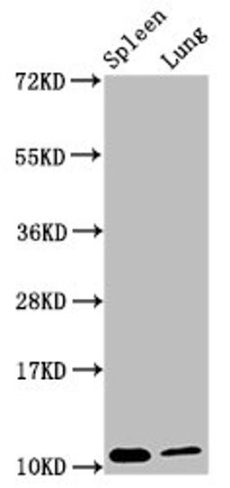 Western Blot. Positive WB detected in: Mouse spleen tissue, Mouse lung tissue. All lanes: S100a8 antibody at 3.8µg/ml. Secondary. Goat polyclonal to rabbit IgG at 1/50000 dilution. Predicted band size: 11 kDa. Observed band size: 11 kDa