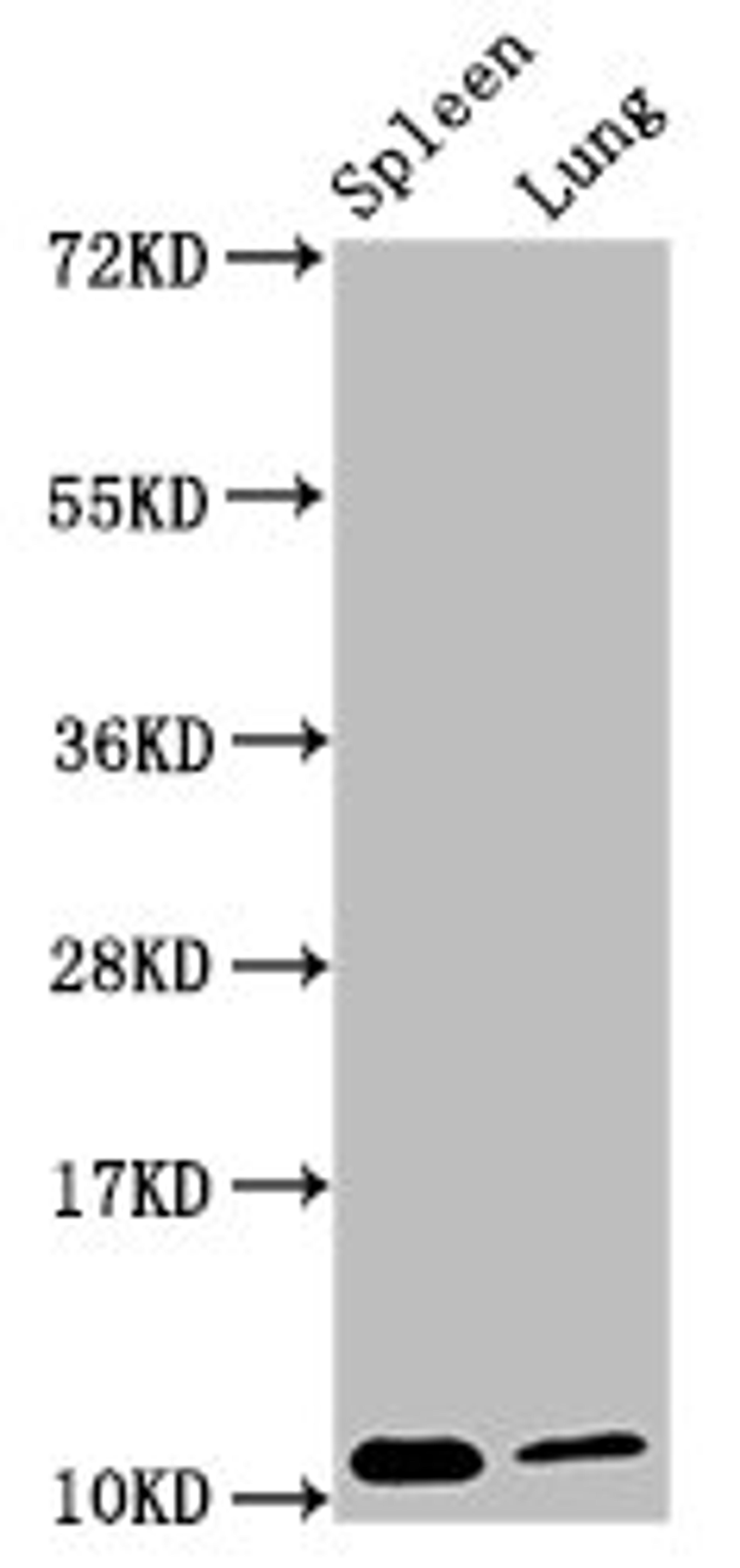 Western Blot. Positive WB detected in: Mouse spleen tissue, Mouse lung tissue. All lanes: S100a8 antibody at 3.8µg/ml. Secondary. Goat polyclonal to rabbit IgG at 1/50000 dilution. Predicted band size: 11 kDa. Observed band size: 11 kDa