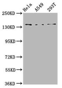 Western Blot. Positive WB detected in: Hela whole cell lysate, A549 whole cell lysate, 293T whole cell lysate. All lanes: CNGB1 antibody at 4.6µg/ml. Secondary. Goat polyclonal to rabbit IgG at 1/50000 dilution. Predicted band size: 140, 71, 33 kDa. Observed band size: 140 kDa