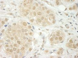 Detection of human THOC5 by immunohistochemistry.