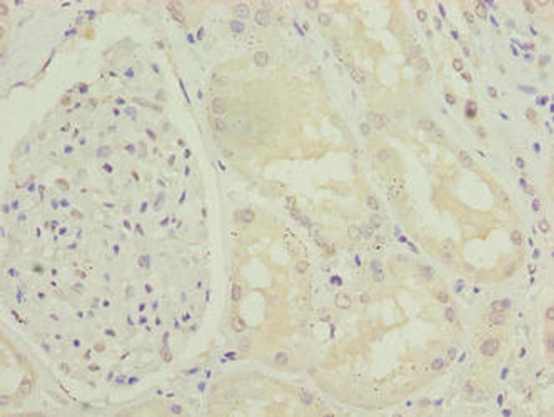 Immunohistochemistry of paraffin-embedded human kidney tissue using CSB-PA740915LA01HU at dilution of 1:100