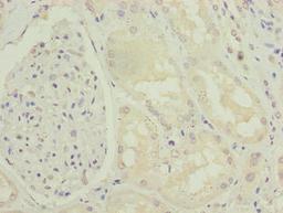Immunohistochemistry of paraffin-embedded human kidney tissue using CSB-PA740915LA01HU at dilution of 1:100
