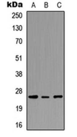 Western blot analysis of MCF7 (Lane1), NS-1 (Lane2), PC12 (Lane3) whole cell using PEX11G antibody