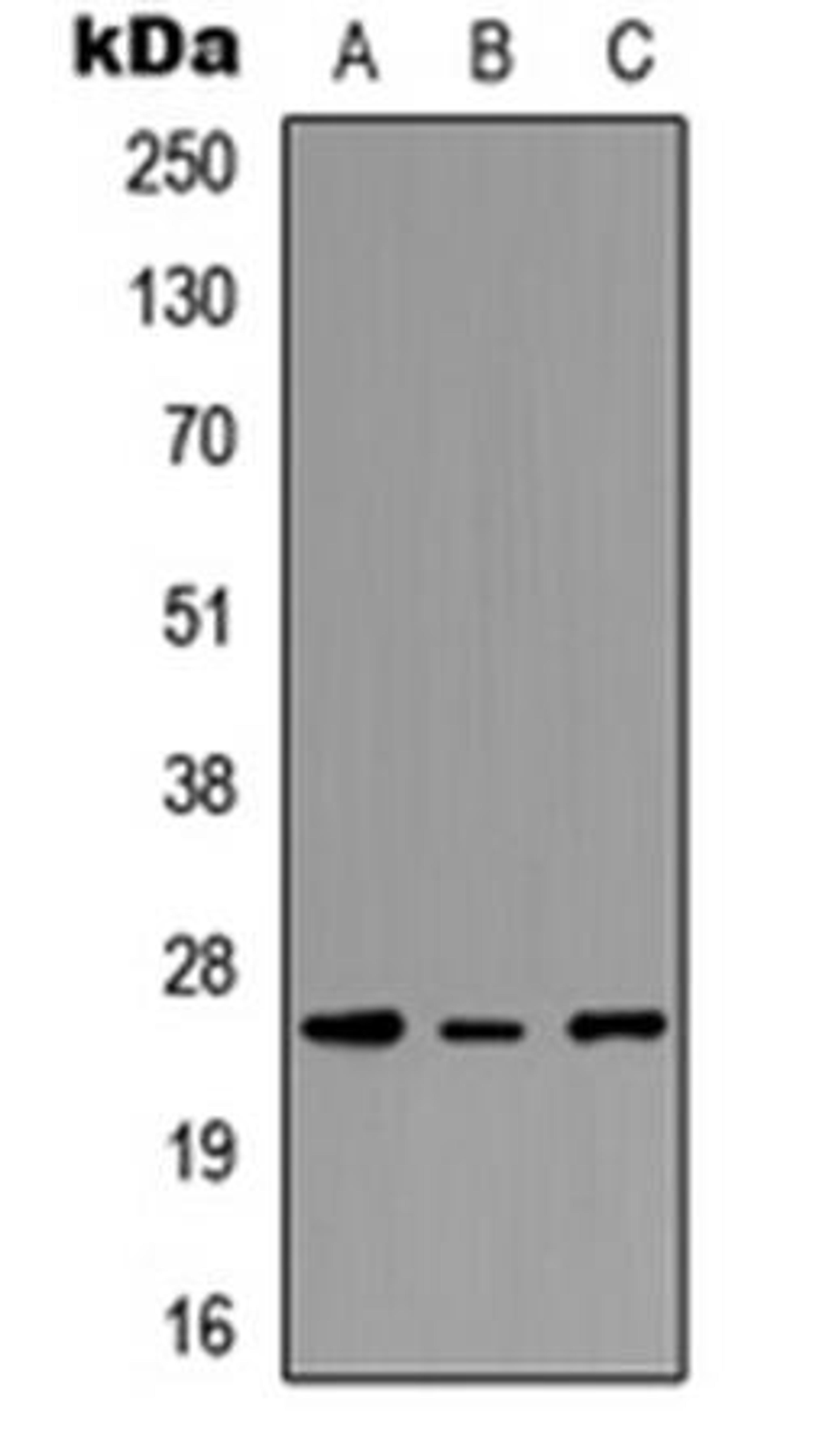 Western blot analysis of MCF7 (Lane1), NS-1 (Lane2), PC12 (Lane3) whole cell using PEX11G antibody