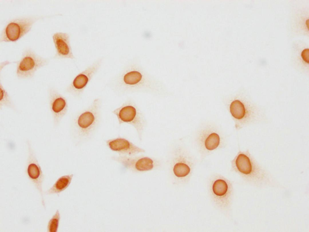 Immunocytochemistry analysis of CSB-PA010377OA137phHU diluted at 1:10 and staining in Hela cells(treated with 50nM Calyculin A for 30min) performed on a Leica BondTM system. The cells were fixed in 4% formaldehyde, permeabilized using 0.2% Triton X-100 and blocked with 10% normal goat serum 30min at RT. Then primary antibody (1% BSA) was incubated at 4°C overnight. The primary is detected by a biotinylated secondary antibody and visualized using an HRP conjugated SP system.