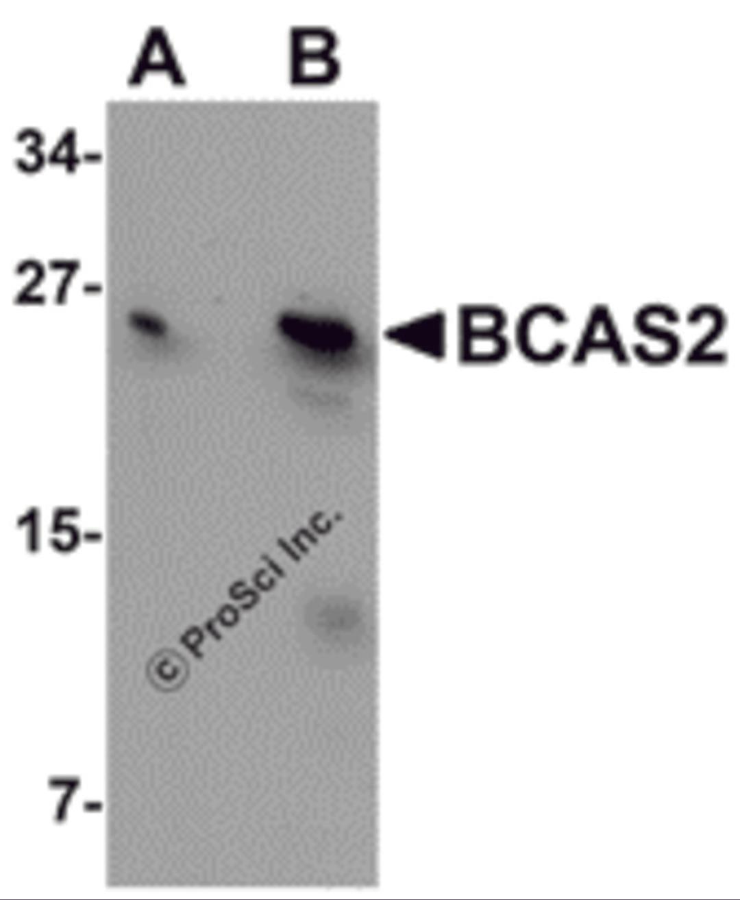 Western blot analysis of BCAS2 in MCF7 cell lysate with BCAS2 antibody at (A) 0.5 and (B) 1 μg/mL.