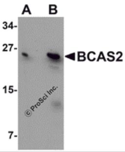 Western blot analysis of BCAS2 in MCF7 cell lysate with BCAS2 antibody at (A) 0.5 and (B) 1 μg/mL.