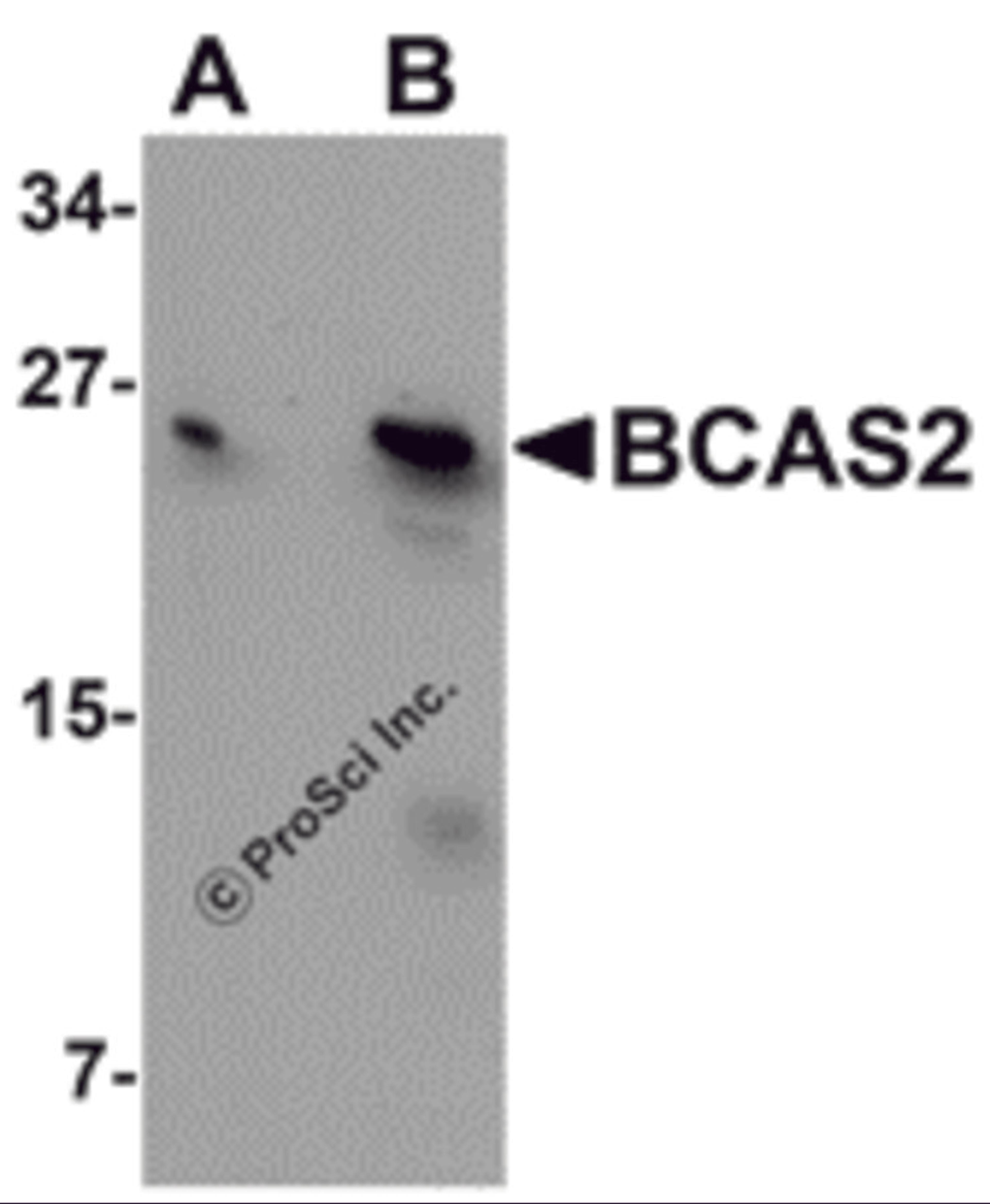 Western blot analysis of BCAS2 in MCF7 cell lysate with BCAS2 antibody at (A) 0.5 and (B) 1 μg/mL.