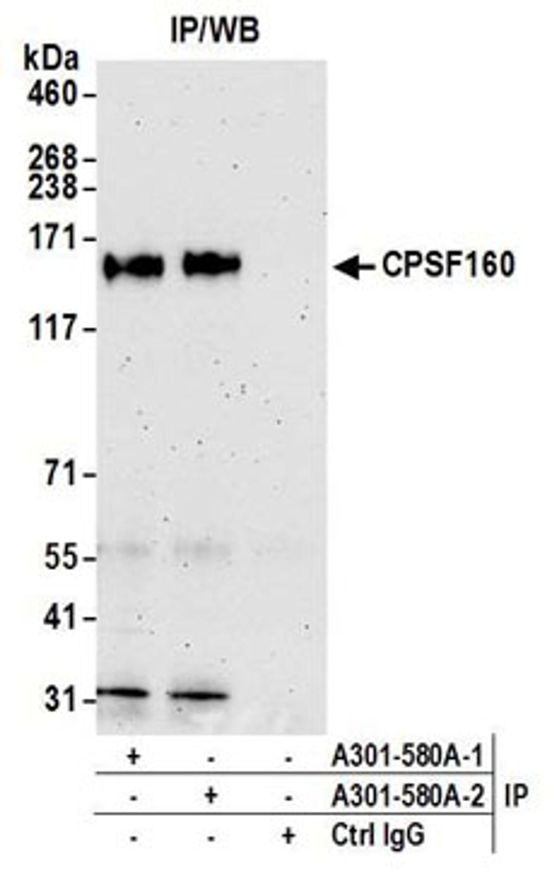 Detection of human CPSF160 by western blot of immunoprecipitates.