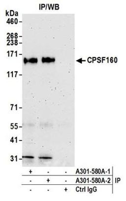 Detection of human CPSF160 by western blot of immunoprecipitates.