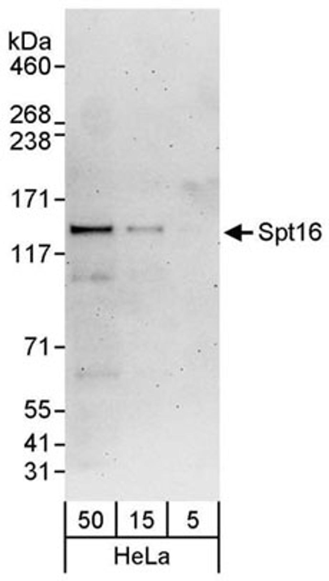 Detection of human Spt16 by western blot.