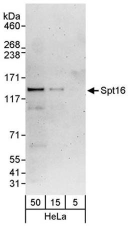 Detection of human Spt16 by western blot.