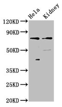Western Blot. Positive WB detected in: Hela whole cell lysate, Rat kidney tissue. All lanes: CLCNKB antibody at 3µg/ml. Secondary. Goat polyclonal to rabbit IgG at 1/50000 dilution. Predicted band size: 76, 57 kDa. Observed band size: 76 kDa