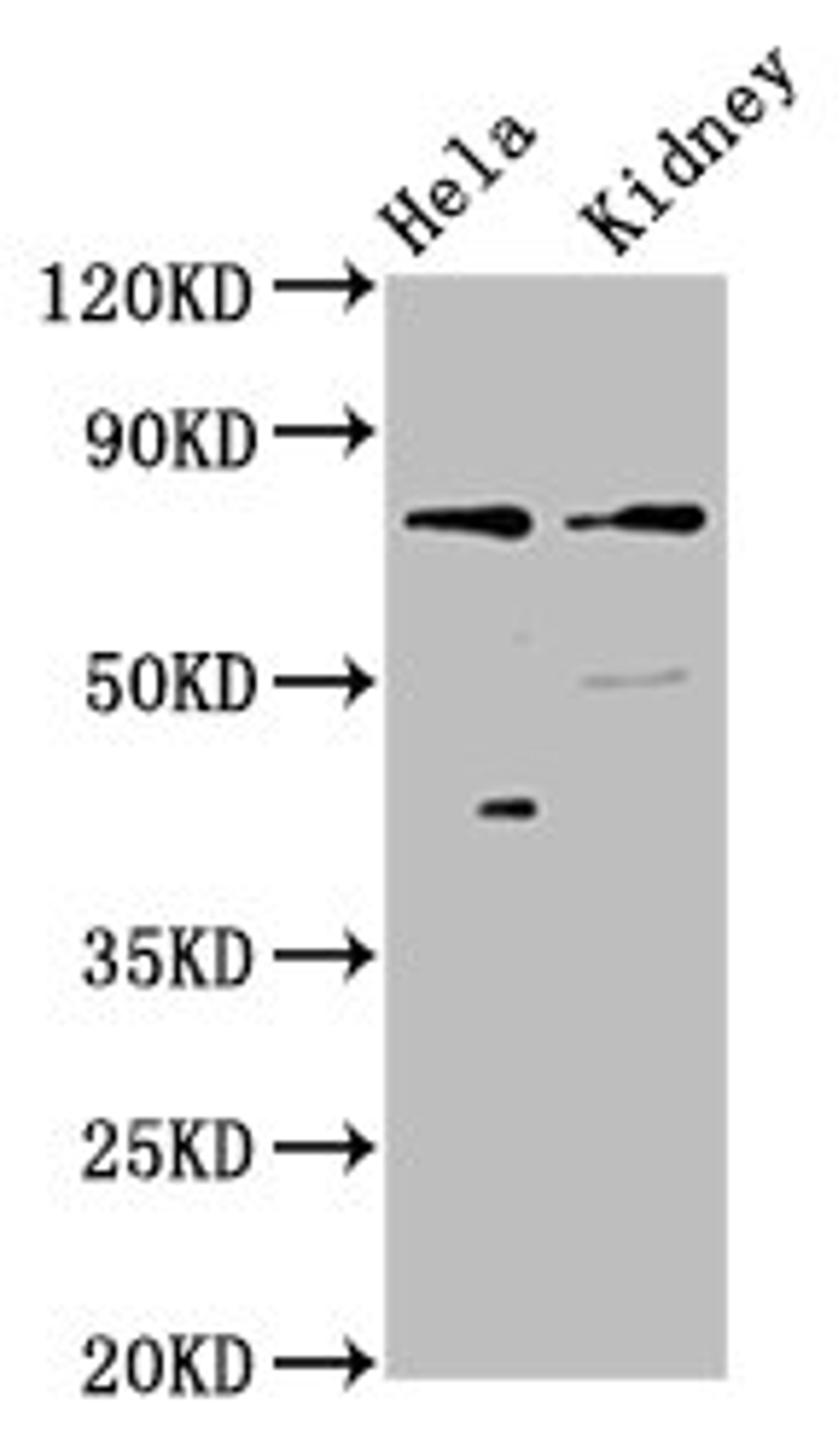 Western Blot. Positive WB detected in: Hela whole cell lysate, Rat kidney tissue. All lanes: CLCNKB antibody at 3µg/ml. Secondary. Goat polyclonal to rabbit IgG at 1/50000 dilution. Predicted band size: 76, 57 kDa. Observed band size: 76 kDa