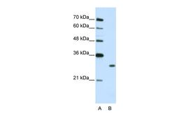 Antibody used in WB on Human Jurkat cells at 2.5 ug/ml.