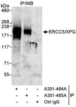 Detection of human ERCC5/XPG by western blot of immunoprecipitates.