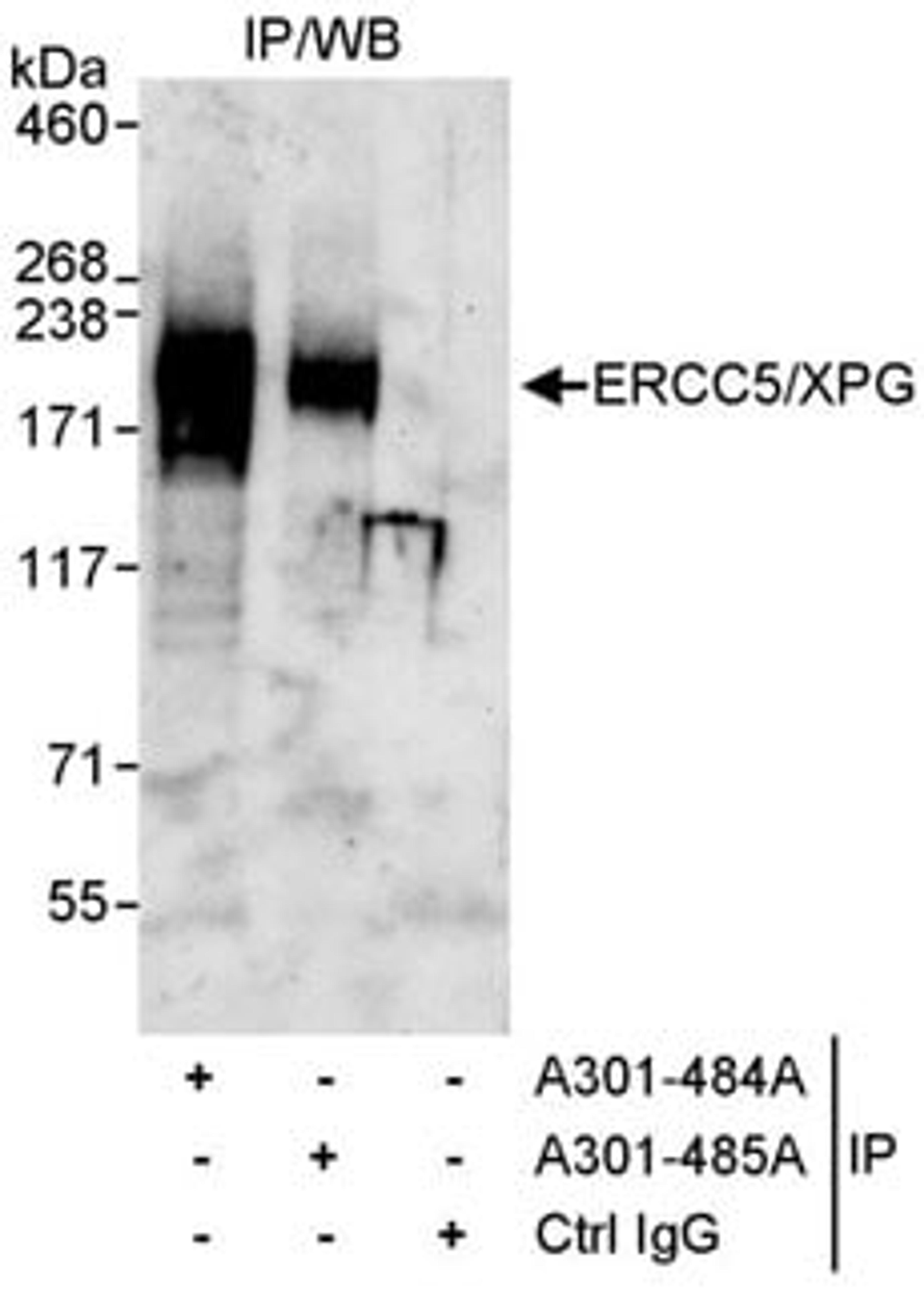 Detection of human ERCC5/XPG by western blot of immunoprecipitates.