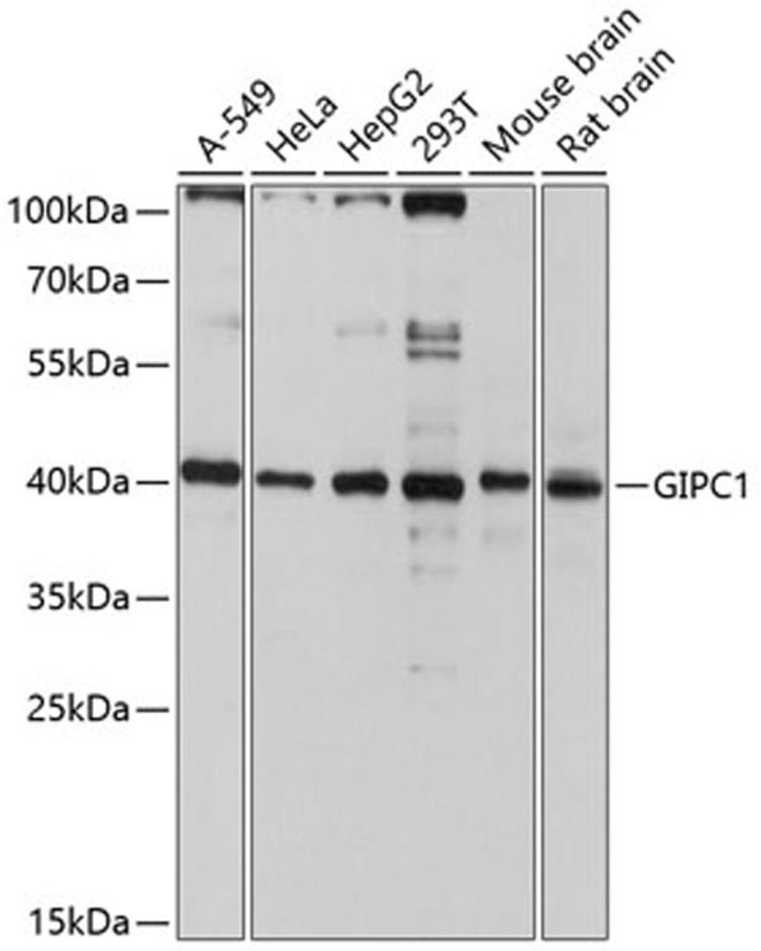 Western blot - GIPC1 antibody (A10550)