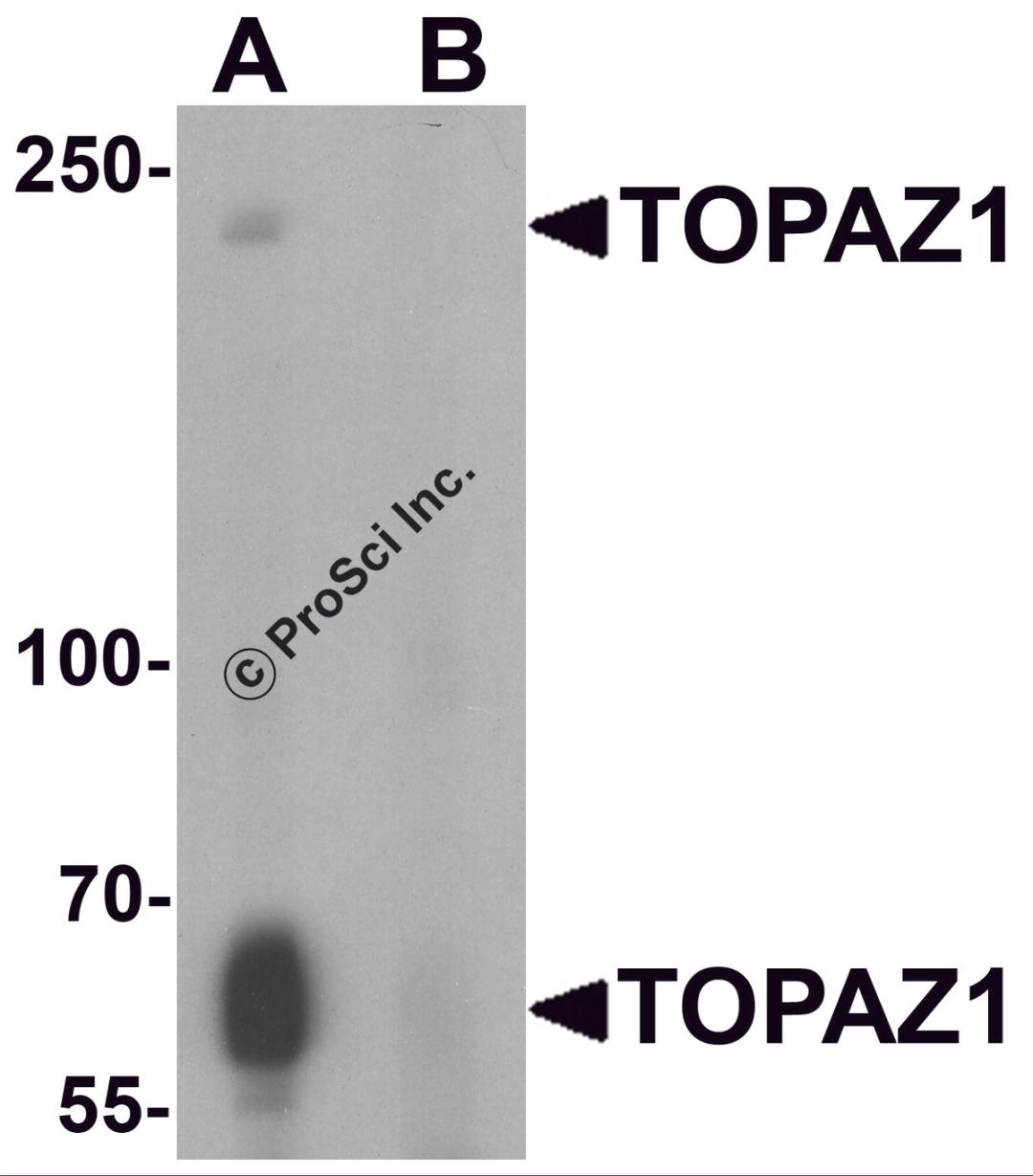 Western blot analysis of TOPAZ1 in human testis tissue lysate with TOPAZ1 antibody at 1 μg/ml in (A) the absence and (B) the presence of blocking peptide.