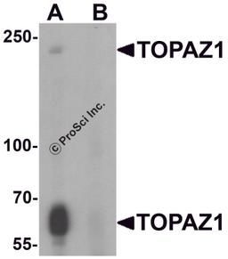 Western blot analysis of TOPAZ1 in human testis tissue lysate with TOPAZ1 antibody at 1 μg/ml in (A) the absence and (B) the presence of blocking peptide.