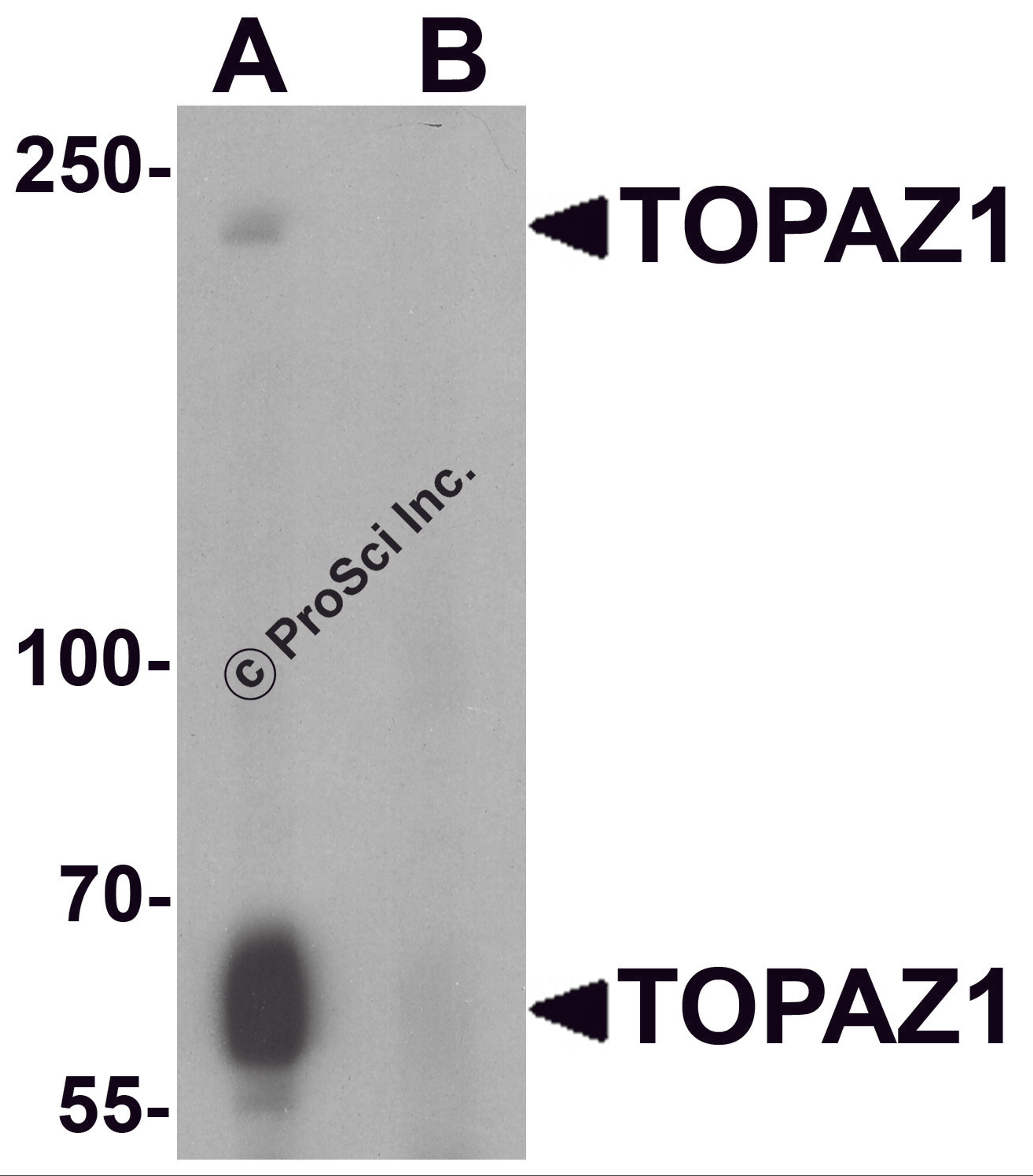 Western blot analysis of TOPAZ1 in human testis tissue lysate with TOPAZ1 antibody at 1 μg/ml in (A) the absence and (B) the presence of blocking peptide.