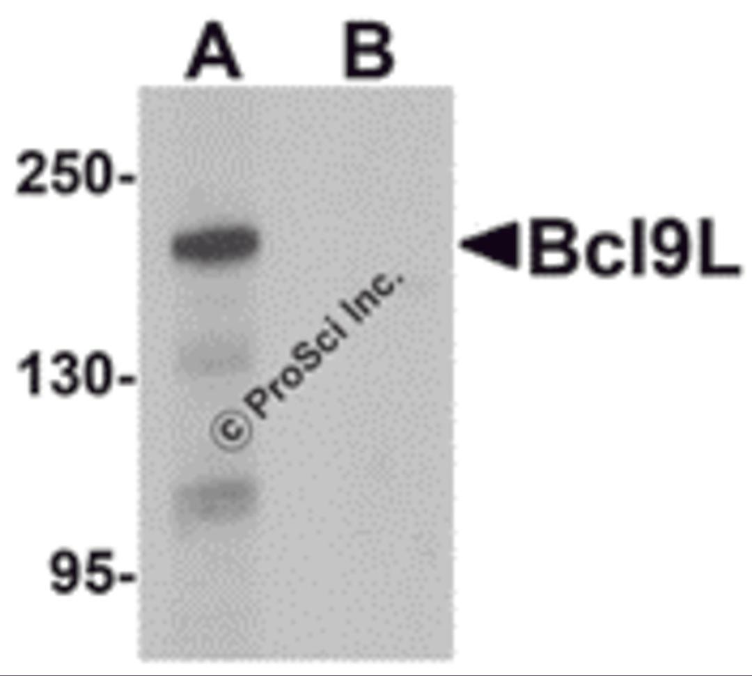 Western blot analysis of Bcl9L in HeLa cell lysate with Bcl9L antibody at 1 &#956;g/mL in (A) the absence and (B) the presence of blocking peptide.