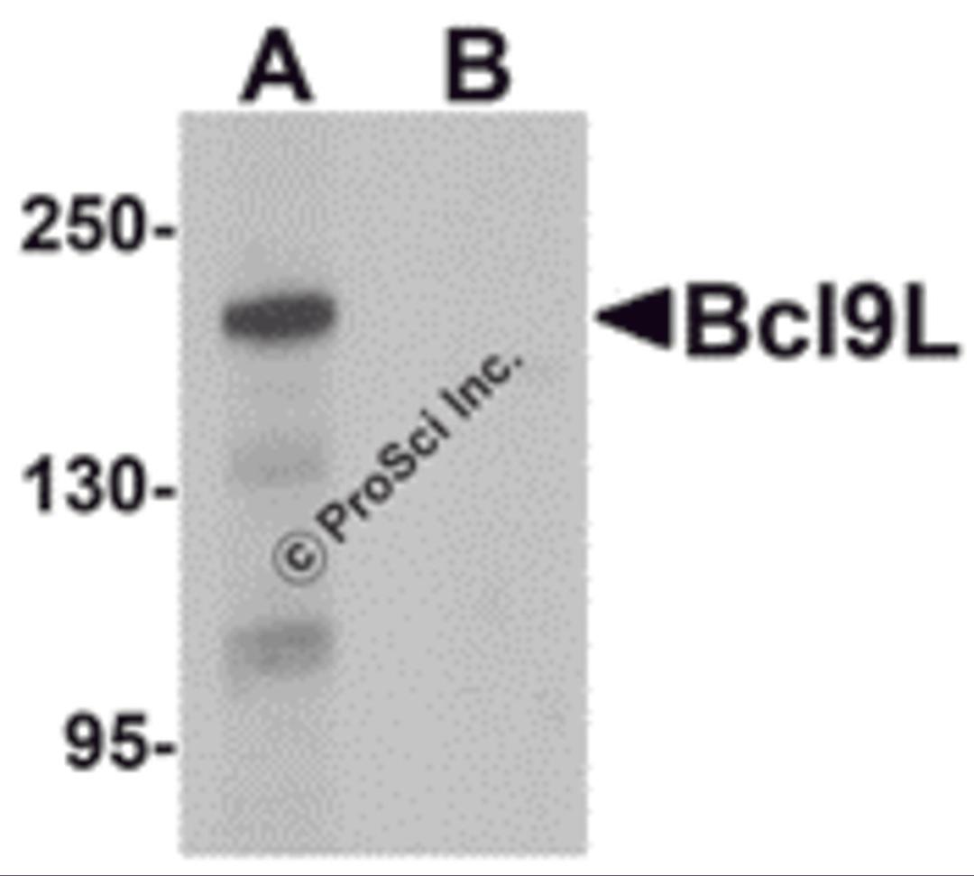 Western blot analysis of Bcl9L in HeLa cell lysate with Bcl9L antibody at 1 μg/mL in (A) the absence and (B) the presence of blocking peptide.