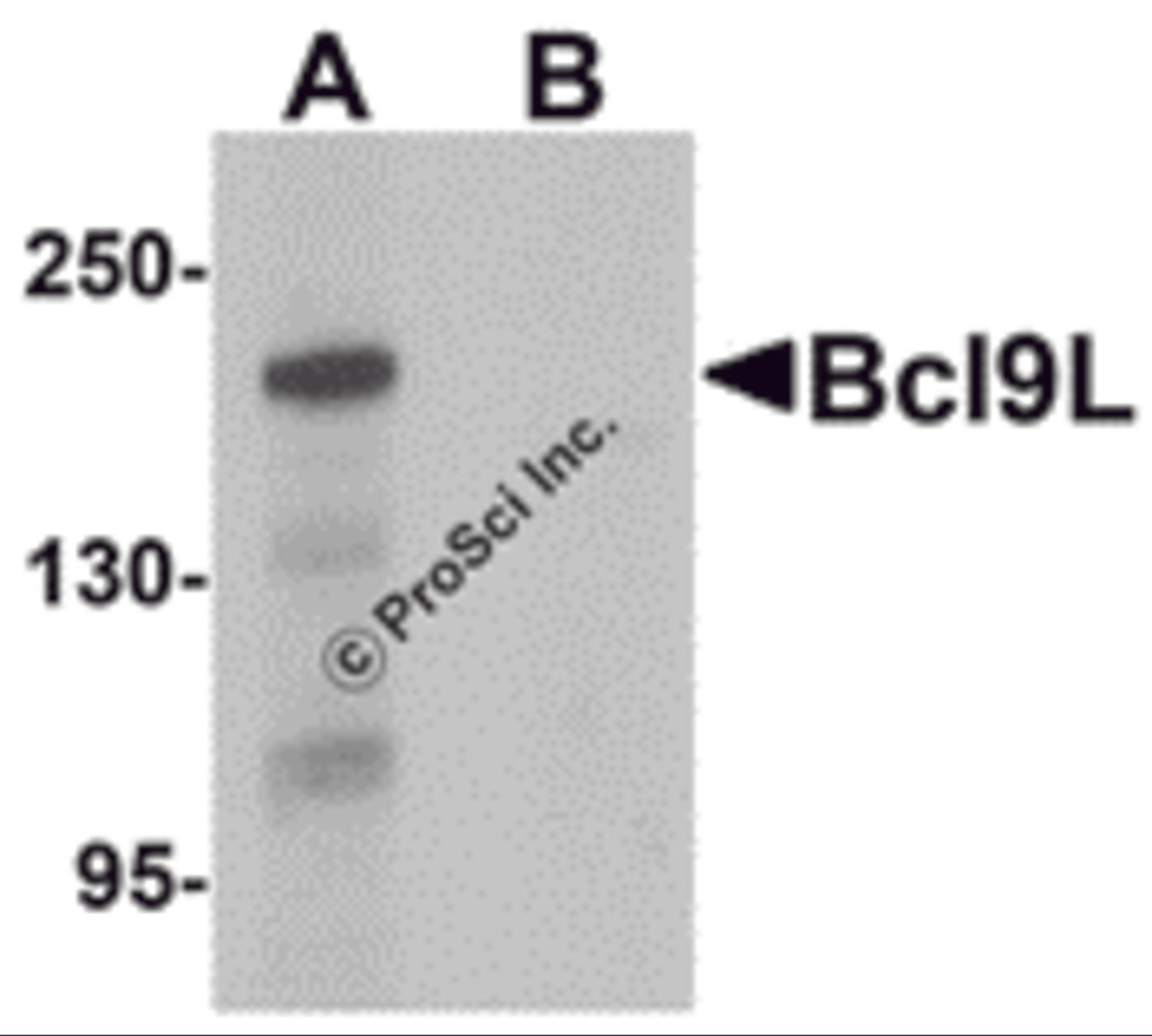 Western blot analysis of Bcl9L in HeLa cell lysate with Bcl9L antibody at 1 μg/mL in (A) the absence and (B) the presence of blocking peptide.