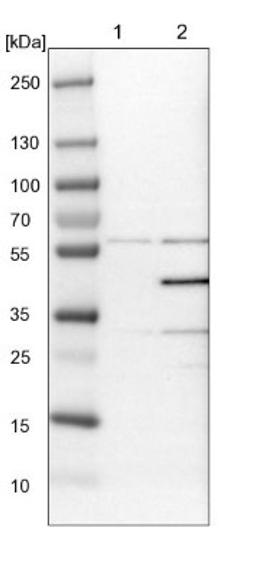 Western Blot: p38 delta/SAPK4 Antibody [NBP1-87373] - Lane 1: NIH-3T3 cell lysate (Mouse embryonic fibroblast cells)<br/>Lane 2: NBT-II cell lysate (Rat Wistar bladder tumour cells)