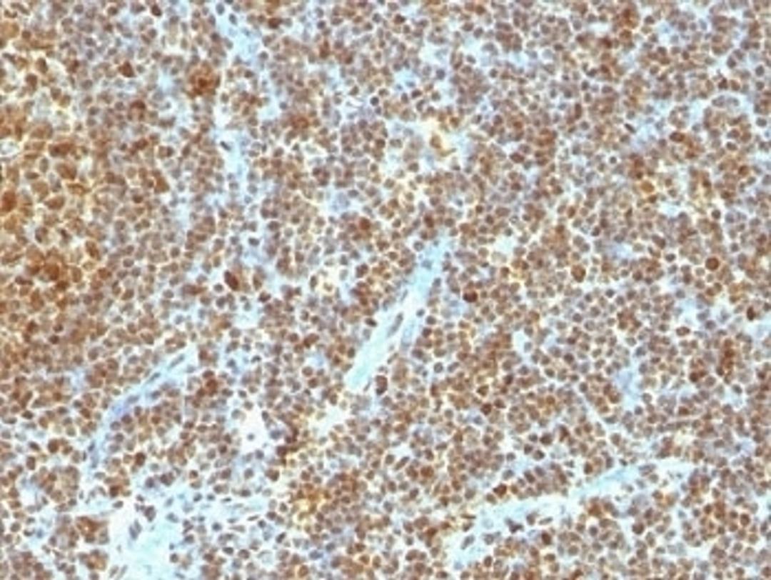 Formalin-fixed, paraffin-embedded human tonsil stained with anti-PCNA antibody (SPM350)