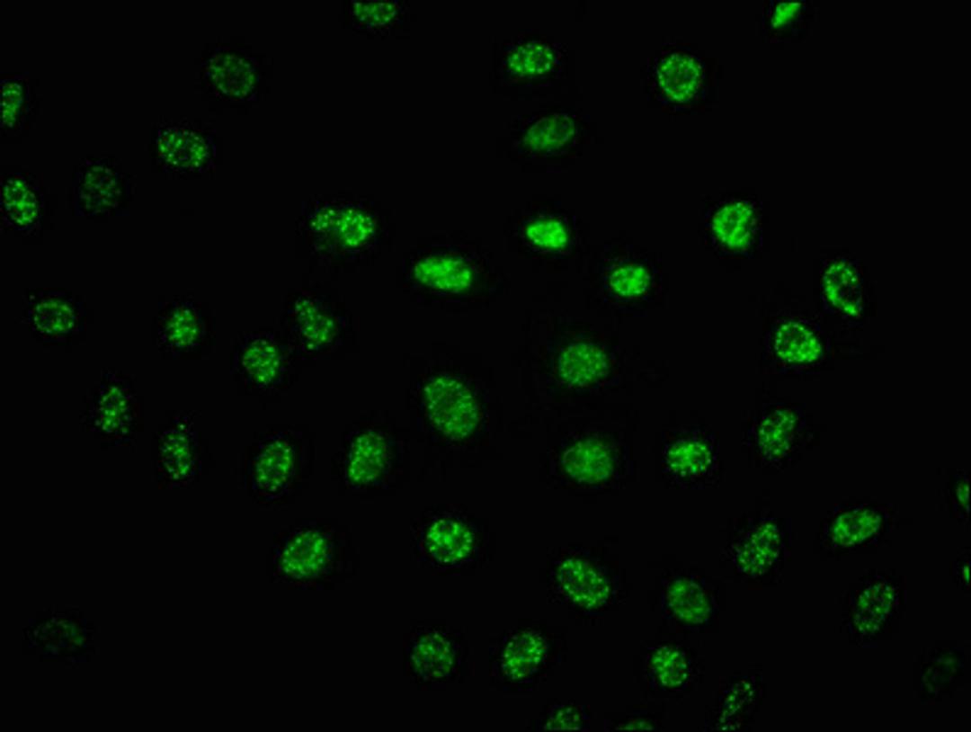 Immunofluorescence staining of Hela cells(treated with UV) with CSB-RA018714A2056phHU at 1:100,counter-stained with DAPI. The cells were fixed in 4% formaldehyde, permeabilized using 0.2% Triton X-100 and blocked in 10% normal Goat Serum. The cells were then incubated with the antibody overnight at 4℃. The secondary antibody was Alexa Fluor 488-congugated AffiniPure Goat Anti-Rabbit IgG (H+L).