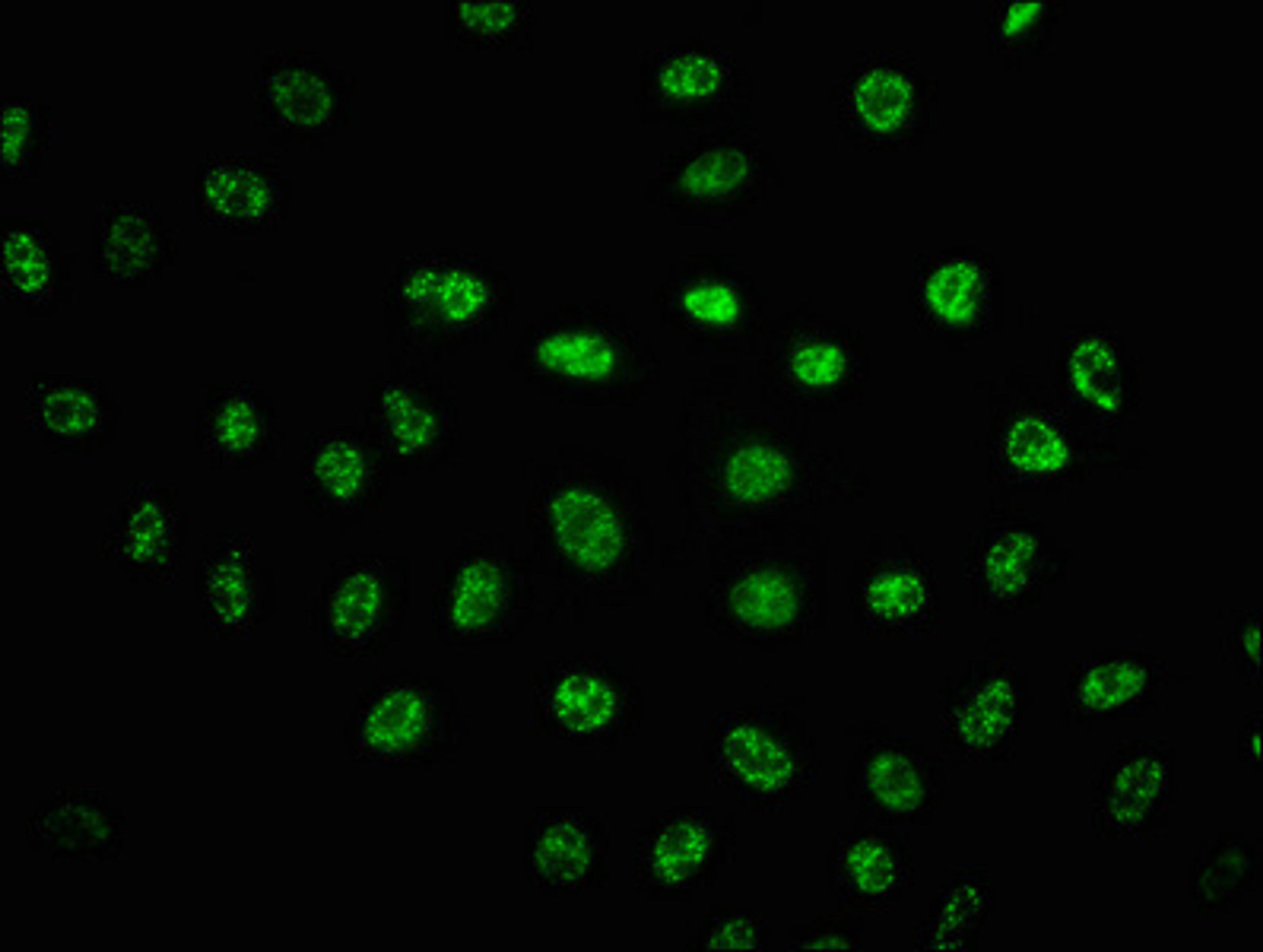 Immunofluorescence staining of Hela cells(treated with UV) with CSB-RA018714A2056phHU at 1:100,counter-stained with DAPI. The cells were fixed in 4% formaldehyde, permeabilized using 0.2% Triton X-100 and blocked in 10% normal Goat Serum. The cells were then incubated with the antibody overnight at 4℃. The secondary antibody was Alexa Fluor 488-congugated AffiniPure Goat Anti-Rabbit IgG (H+L).
