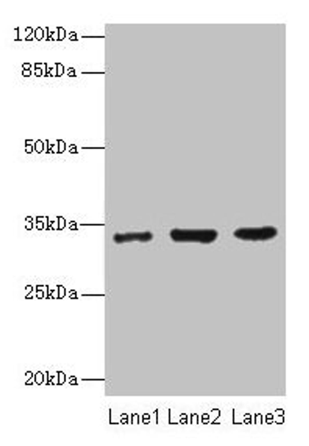 Western blot. All lanes: NAPA antibody at 7µg/ml. Lane 1: 293T whole cell lysate. Lane 2: Hela whole cell lysate. Lane 3: K562 whole cell lysate. Secondary. Goat polyclonal to rabbit IgG at 1/10000 dilution. Predicted band size: 34 kDa. Observed band size: 34 kDa