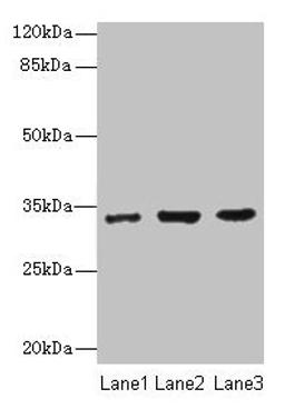 Western blot. All lanes: NAPA antibody at 7µg/ml. Lane 1: 293T whole cell lysate. Lane 2: Hela whole cell lysate. Lane 3: K562 whole cell lysate. Secondary. Goat polyclonal to rabbit IgG at 1/10000 dilution. Predicted band size: 34 kDa. Observed band size: 34 kDa