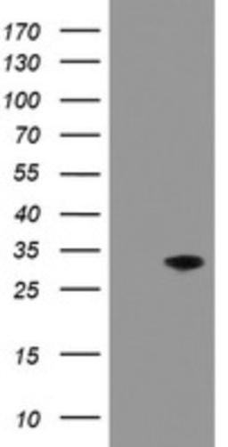 Western Blot: PNPO Antibody (1G9) [NBP2-45361] - Analysis of HEK293T cells were transfected with the pCMV6-ENTRY control (Left lane) or pCMV6-ENTRY PNPO .