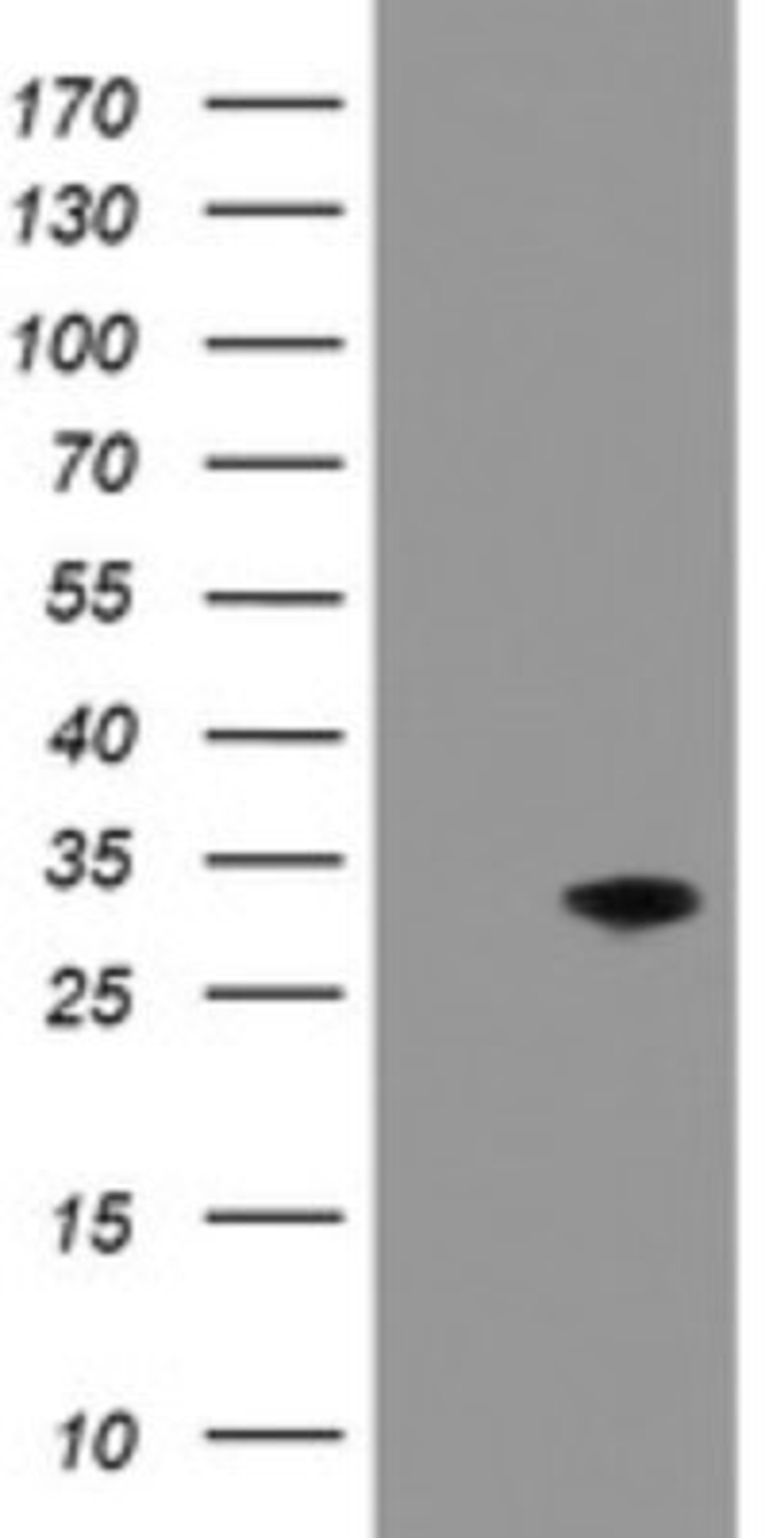 Western Blot: PNPO Antibody (1G9) [NBP2-45361] - Analysis of HEK293T cells were transfected with the pCMV6-ENTRY control (Left lane) or pCMV6-ENTRY PNPO .