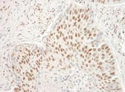 Detection of human Aly by immunohistochemistry.