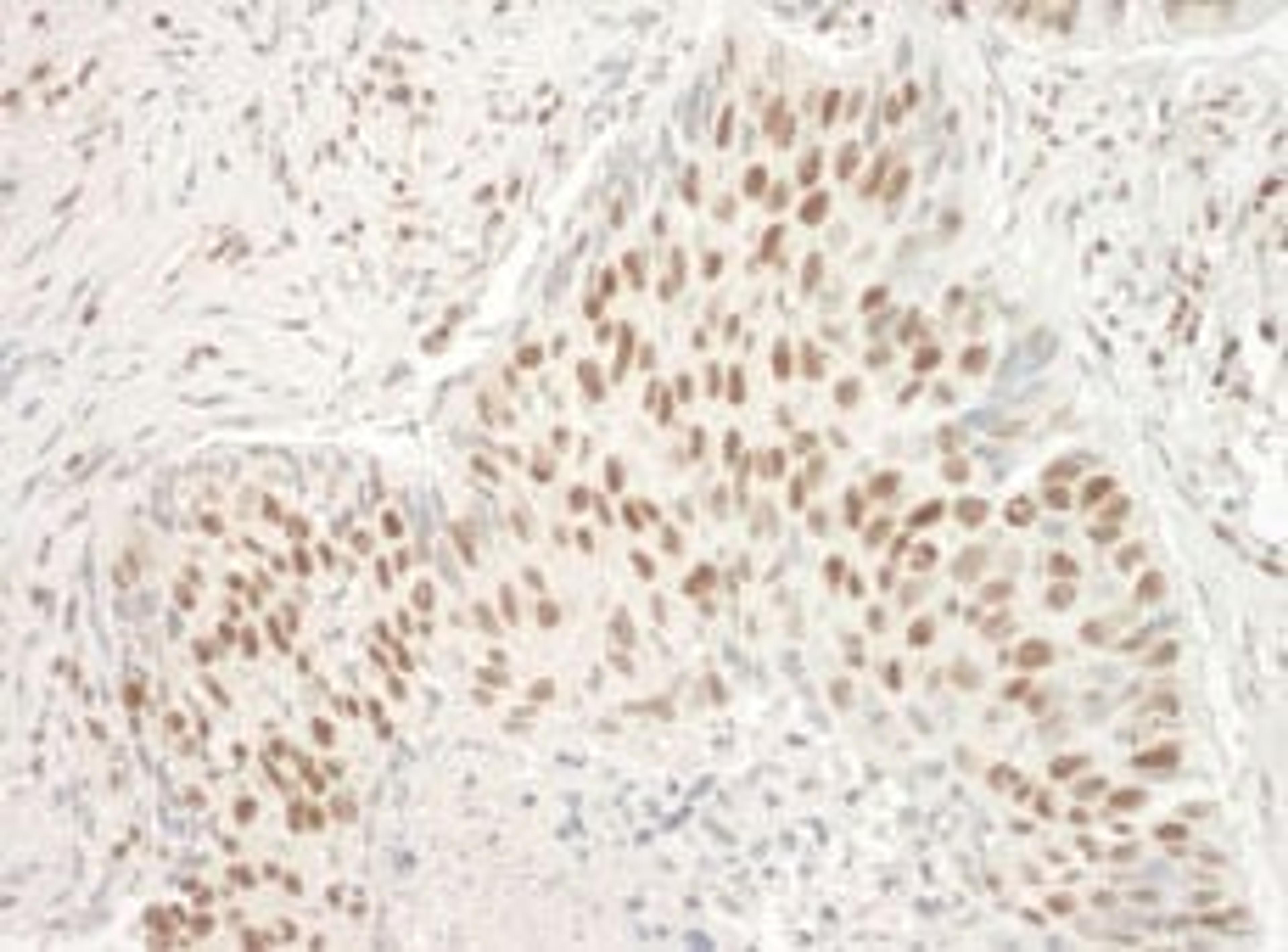 Detection of human Aly by immunohistochemistry.