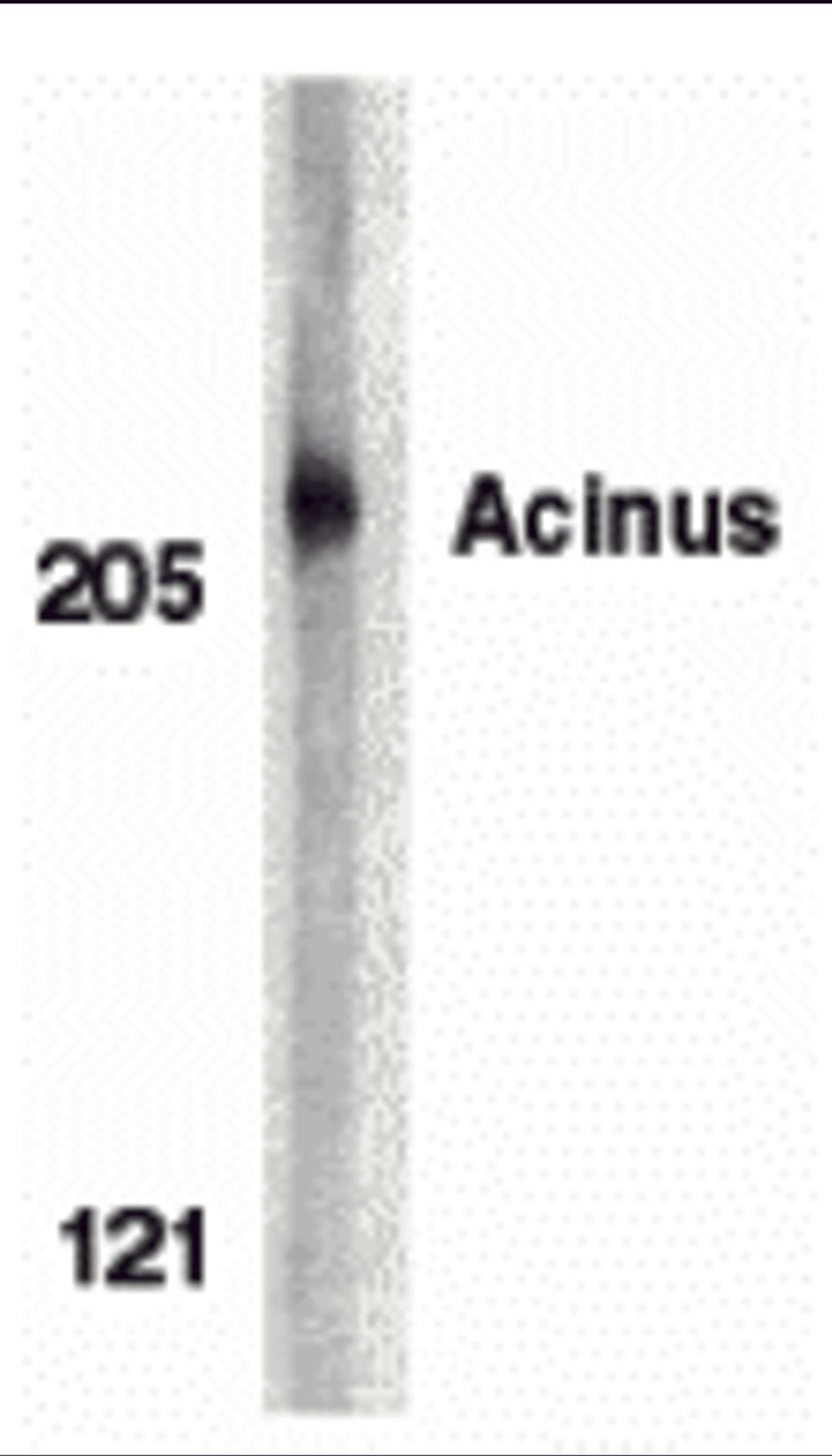 Western blot analysis of acinus in K562 whole cell lysate with acinus antibody at 1 &#956;g/mL.