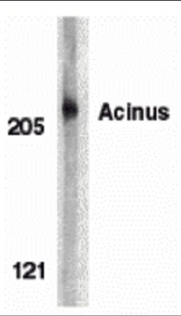 Western blot analysis of acinus in K562 whole cell lysate with acinus antibody at 1 &#956;g/mL.