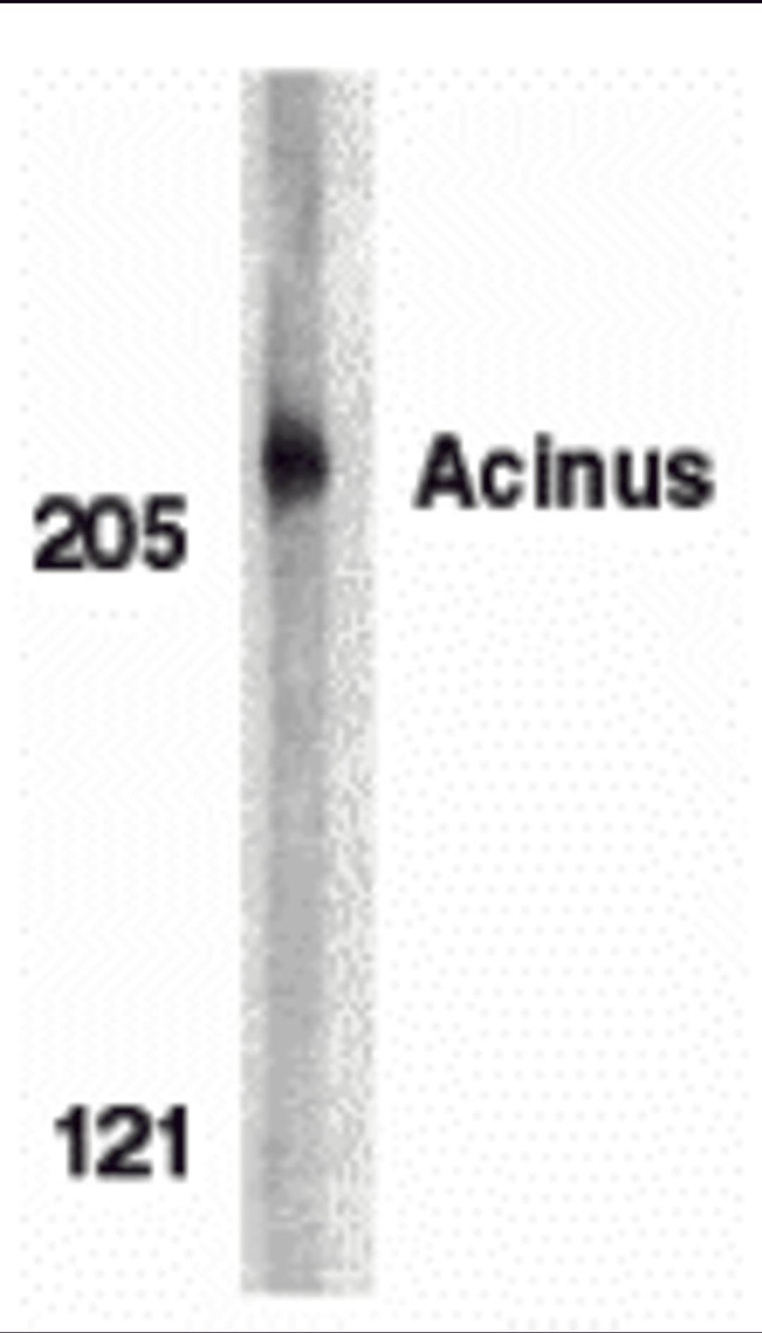 Western blot analysis of acinus in K562 whole cell lysate with acinus antibody at 1 μg/mL.