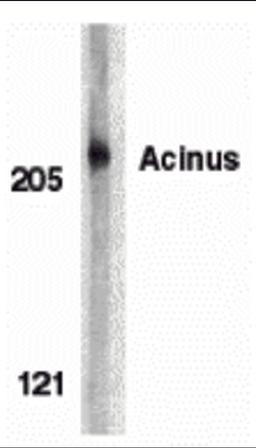 Western blot analysis of acinus in K562 whole cell lysate with acinus antibody at 1 μg/mL.