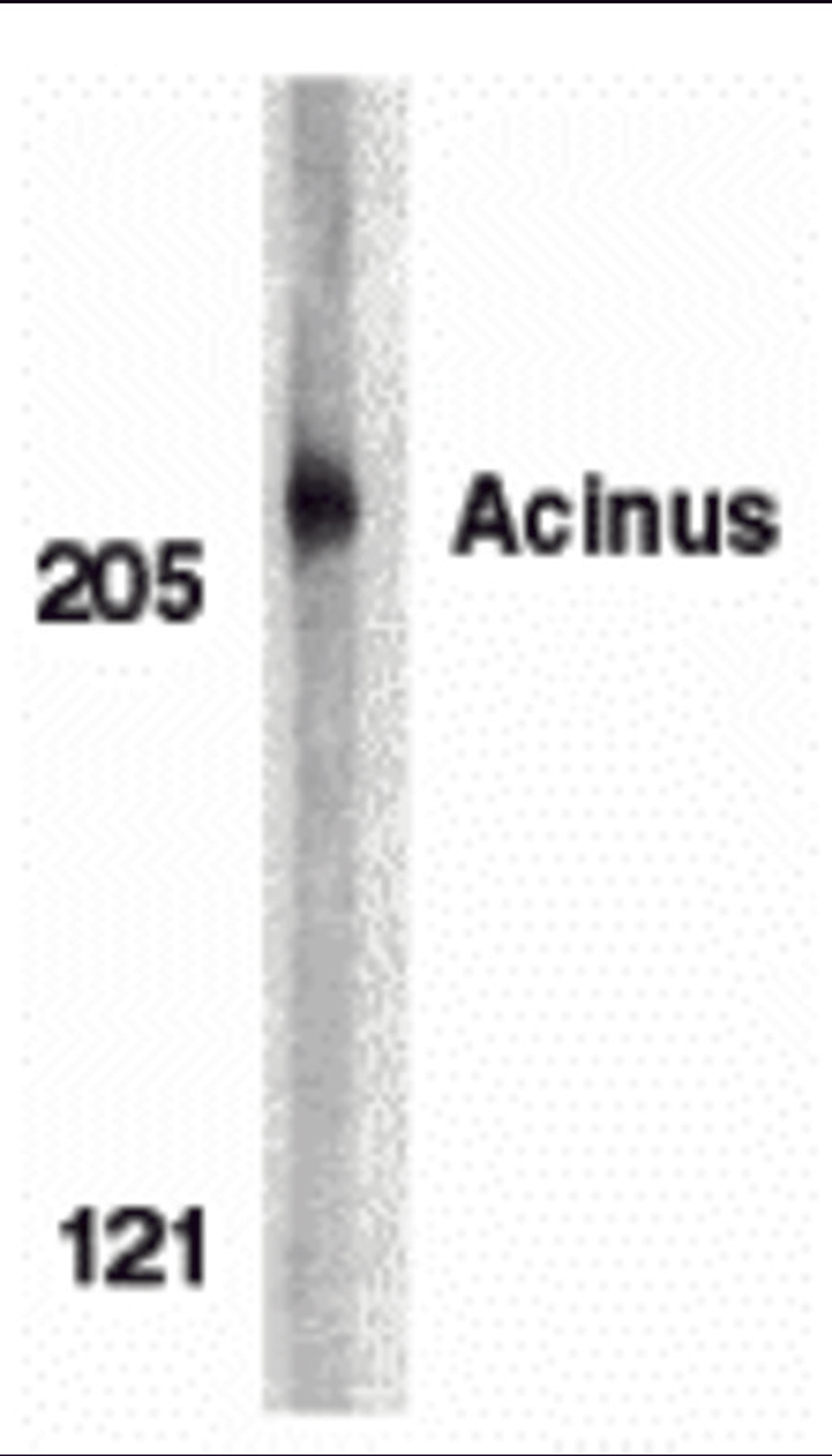 Western blot analysis of acinus in K562 whole cell lysate with acinus antibody at 1 μg/mL.
