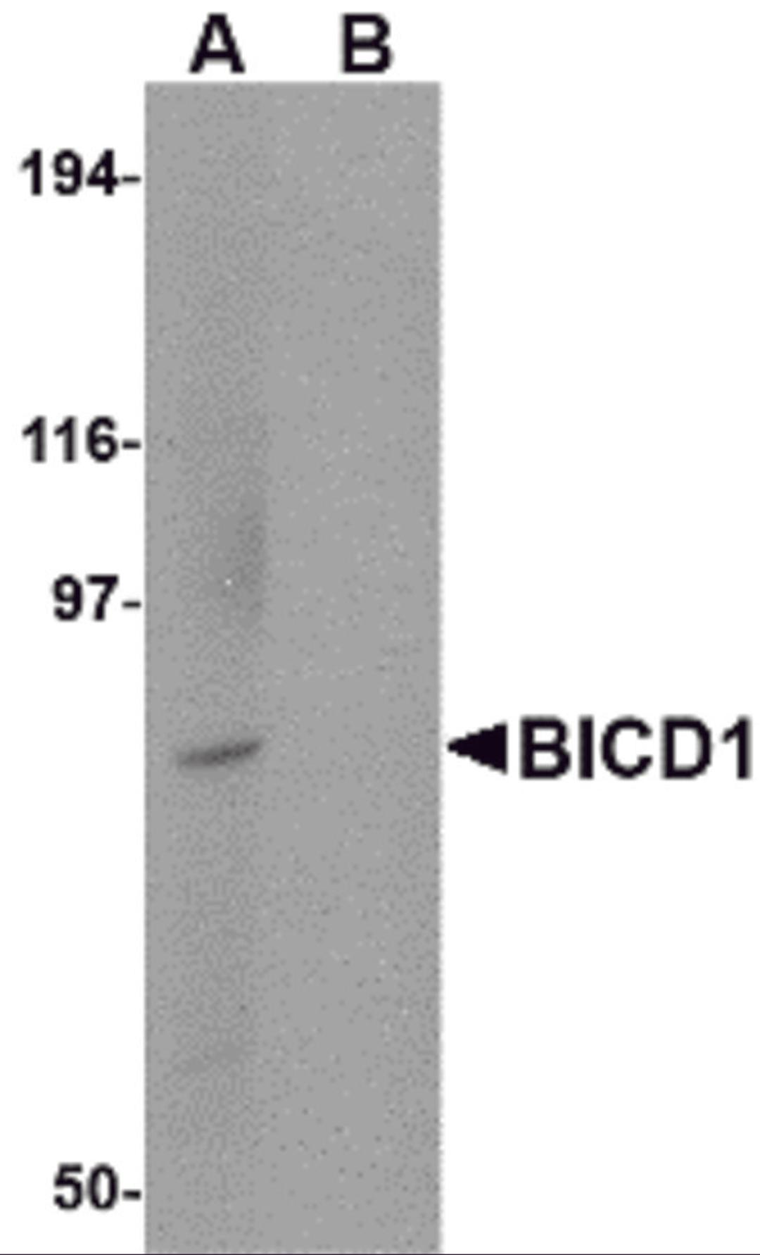 Western blot analysis of BICD1 in Daudi cell lysate with BICD1 antibody at 1 μg/mL in (A) the absence and (B) the presence of blocking peptide.