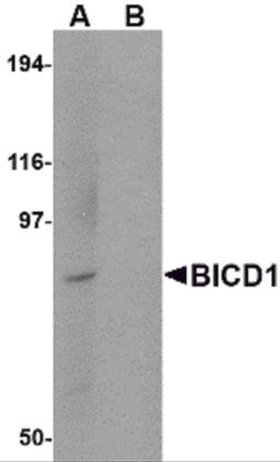 Western blot analysis of BICD1 in Daudi cell lysate with BICD1 antibody at 1 μg/mL in (A) the absence and (B) the presence of blocking peptide.