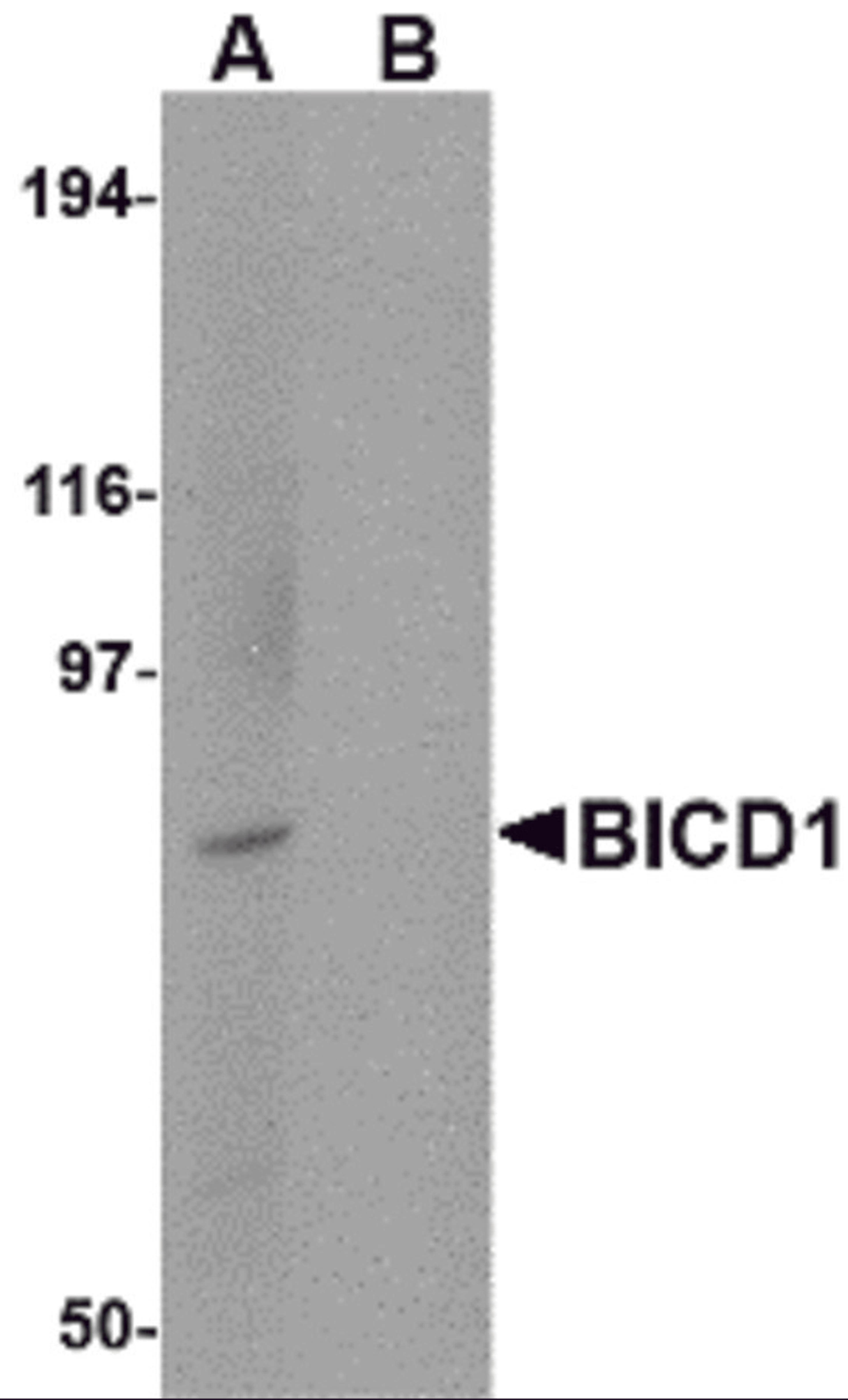 Western blot analysis of BICD1 in Daudi cell lysate with BICD1 antibody at 1 μg/mL in (A) the absence and (B) the presence of blocking peptide.
