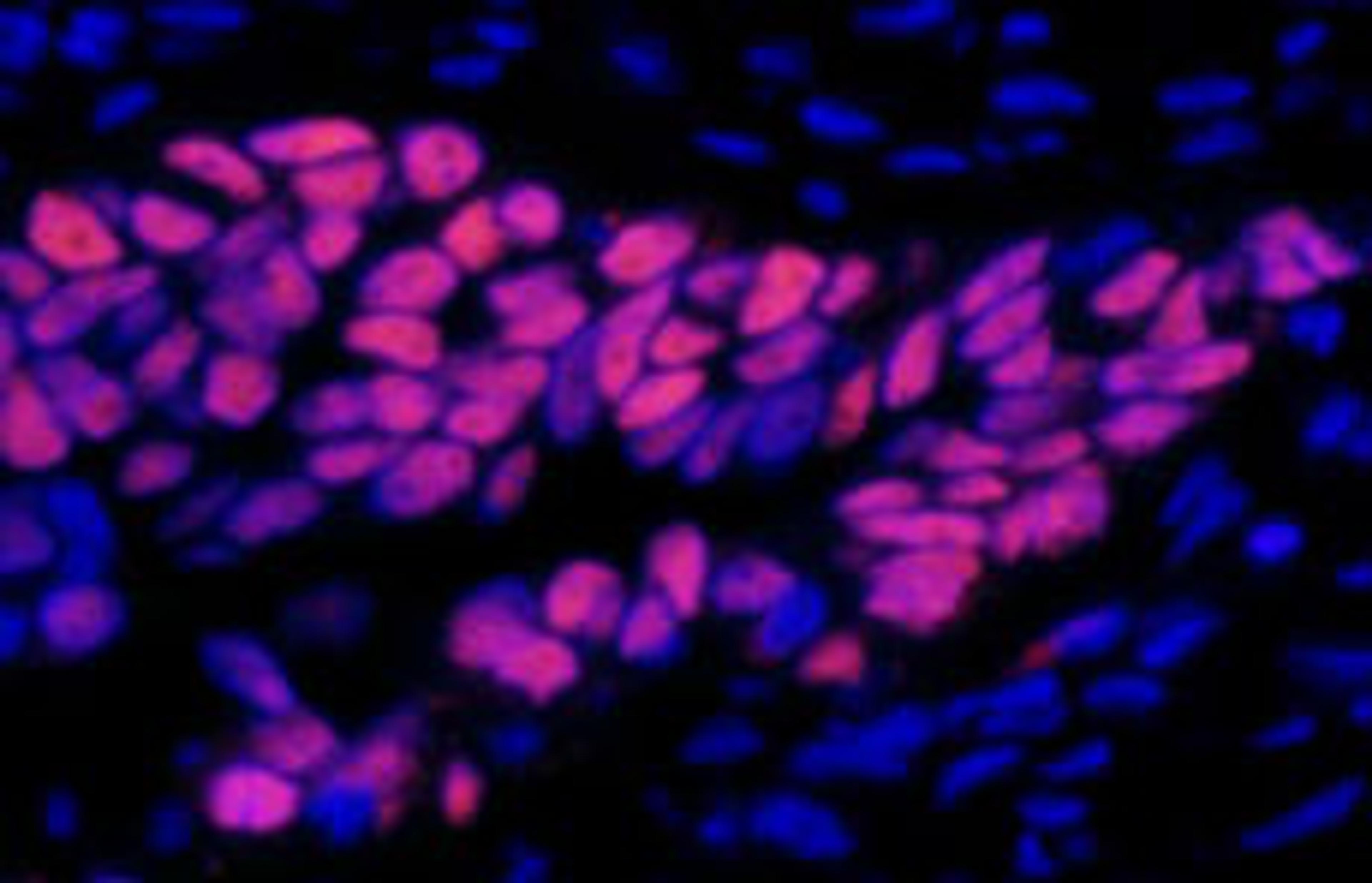 Detection of human p53 by immunofluorescence.