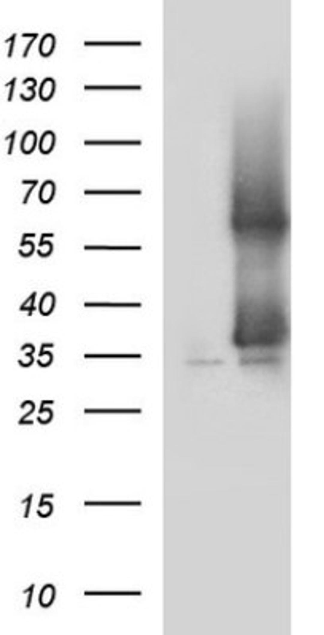 Western Blot: SCAMP2 Antibody (1H10) [NBP2-45688] - Analysis of HEK293T cells were transfected with the pCMV6-ENTRY control (Left lane) or pCMV6-ENTRY SCAMP2.